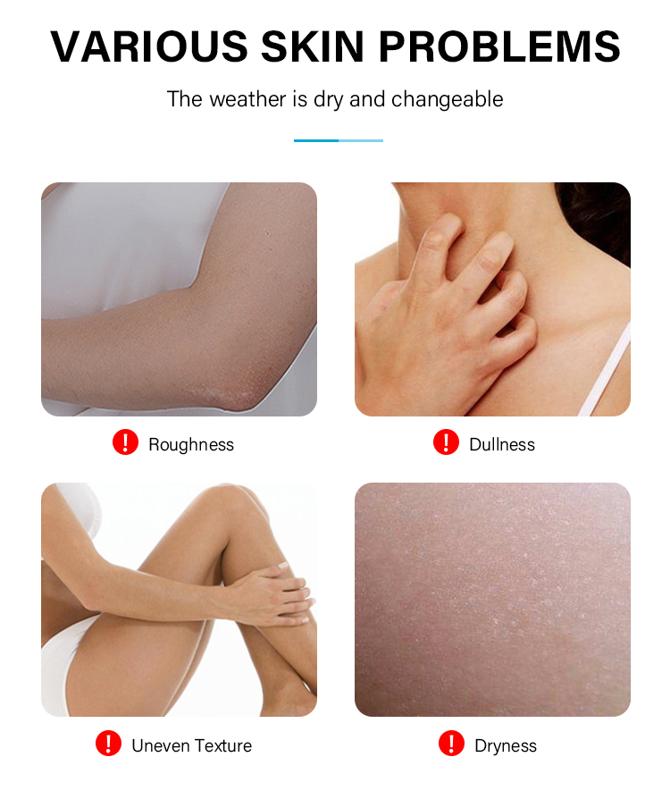 Niacinamide Whitening Lotion 2