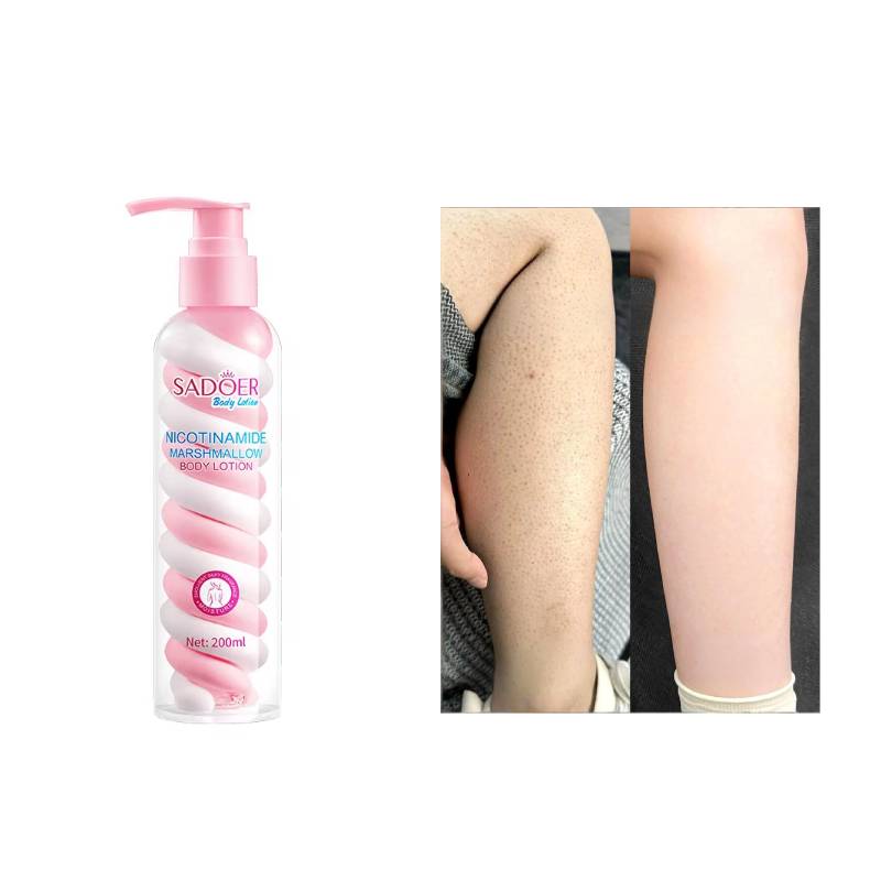 Vitamin C Rich Organic Body Lotion for Extreme Winter Dry Skin Care Herbal Moisturizing Cream Adults Sensitive Skin