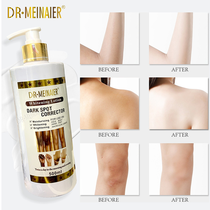 Organic Vitamin C Glutathione Brightening Body Lotion Hydrating Nourishing Knuckles Joints Daily Skincare