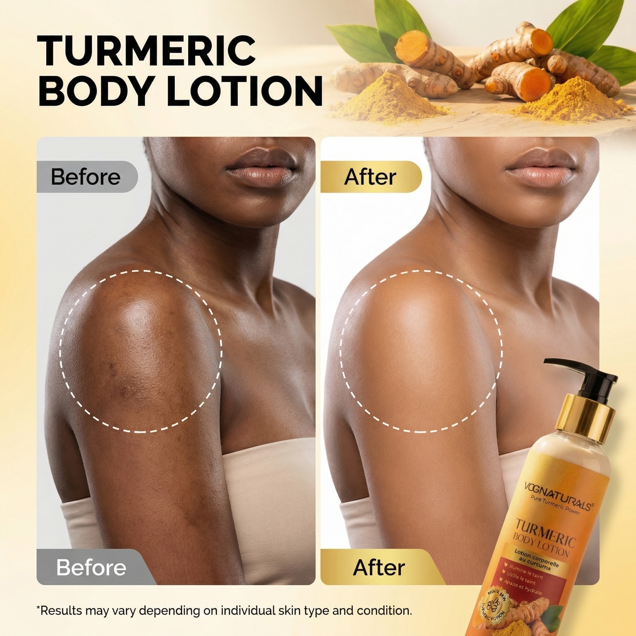 Pure Turmeric Whitening Body Lotion, Soothing Moisturizing Brightening Body Cream For Women Dark Spots Removal