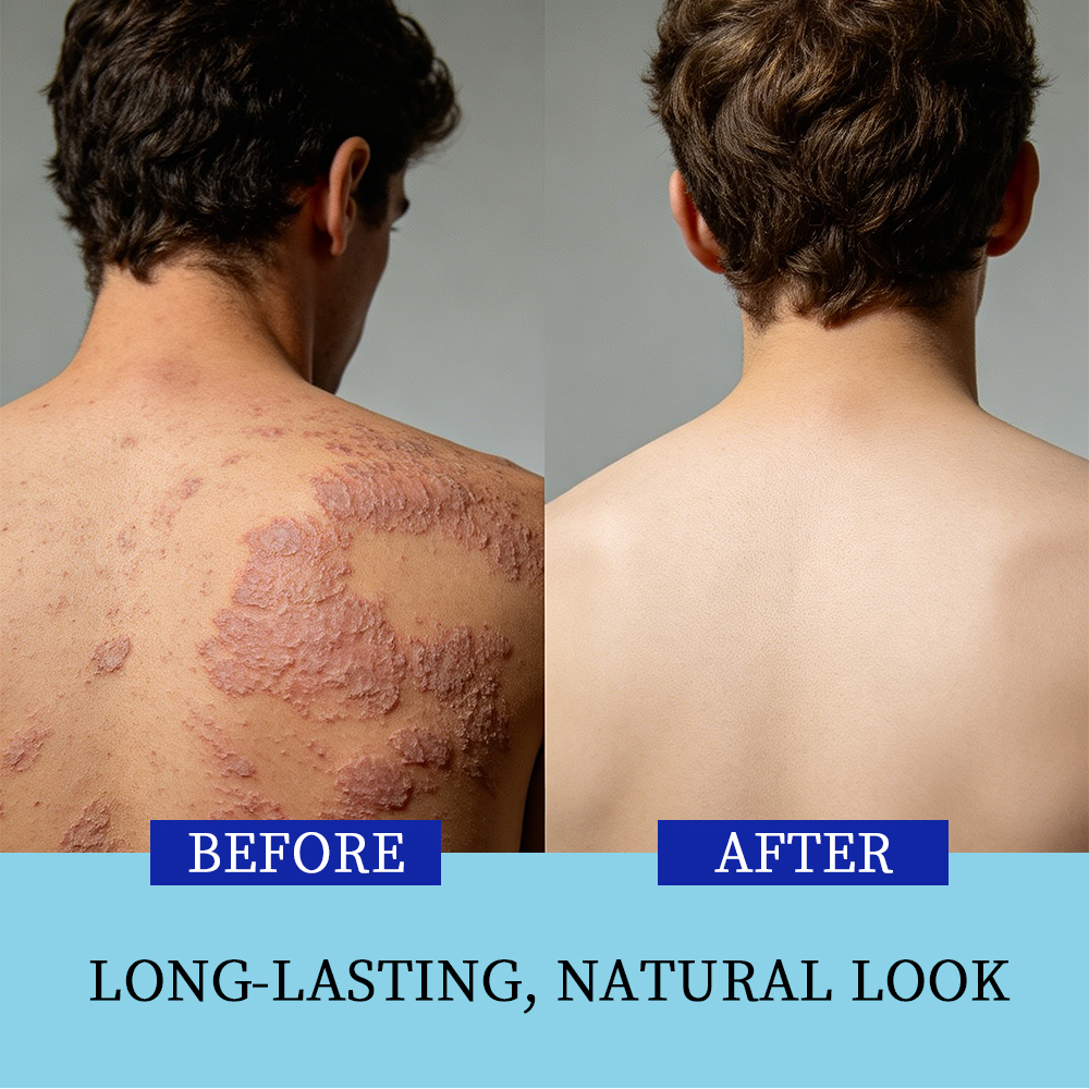 Private Label Premium Natural Herbal Skin Care Product 24H Hydrating Soothing Psoriasis Moisturizing Cream
