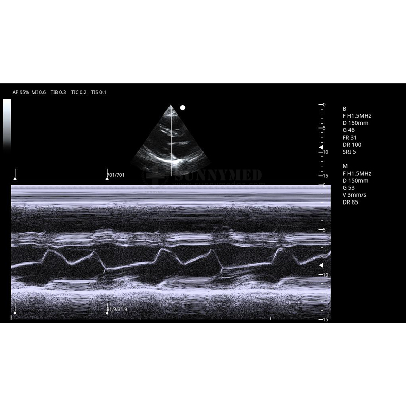 17 Inch LED Color Doppler Ultrasonic Diagnostic System
