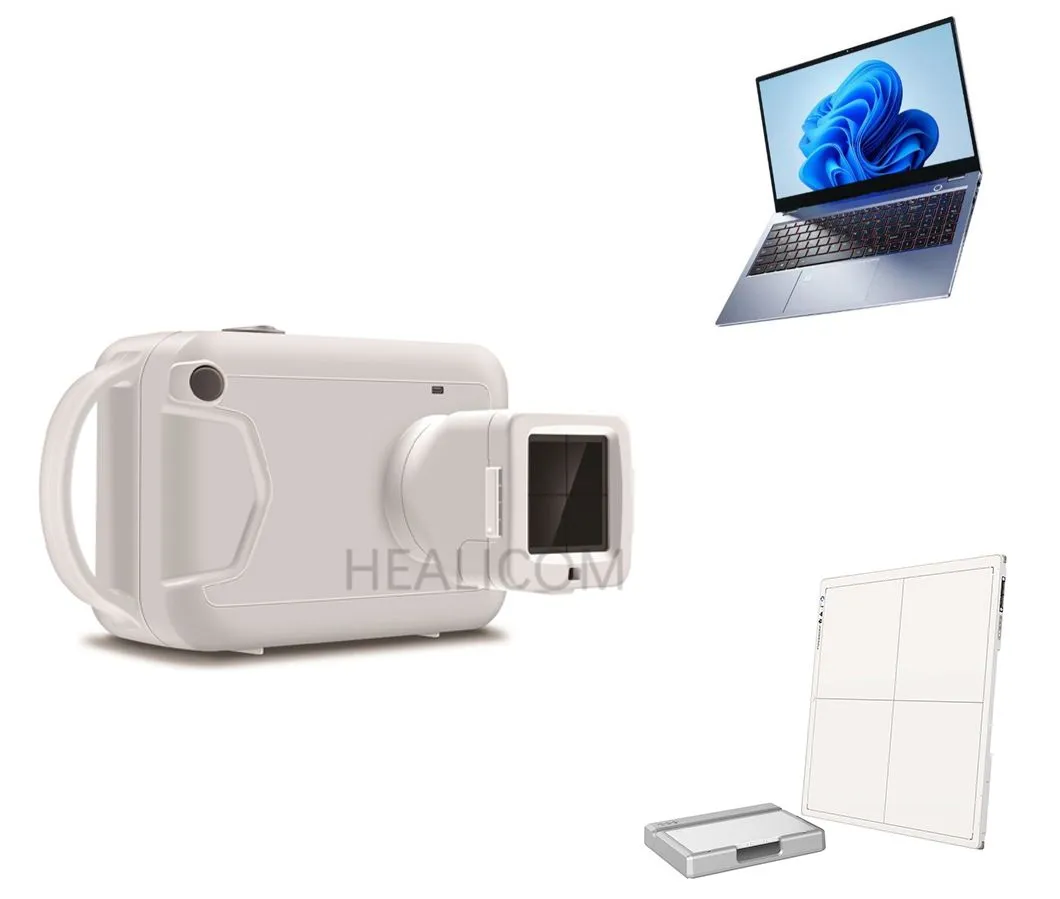 Digital Portable X-ray System