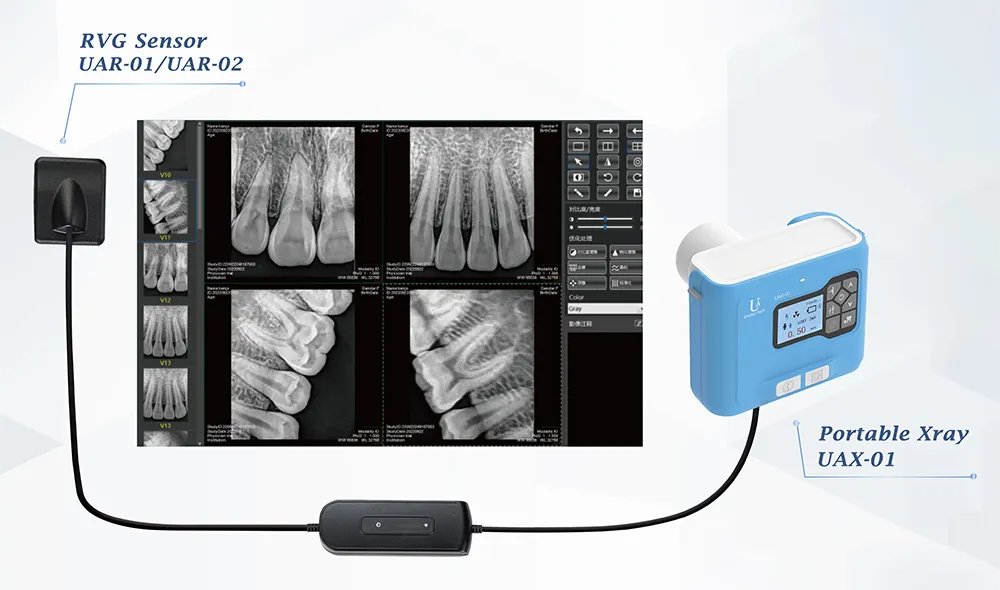 Dental Portable X-ray