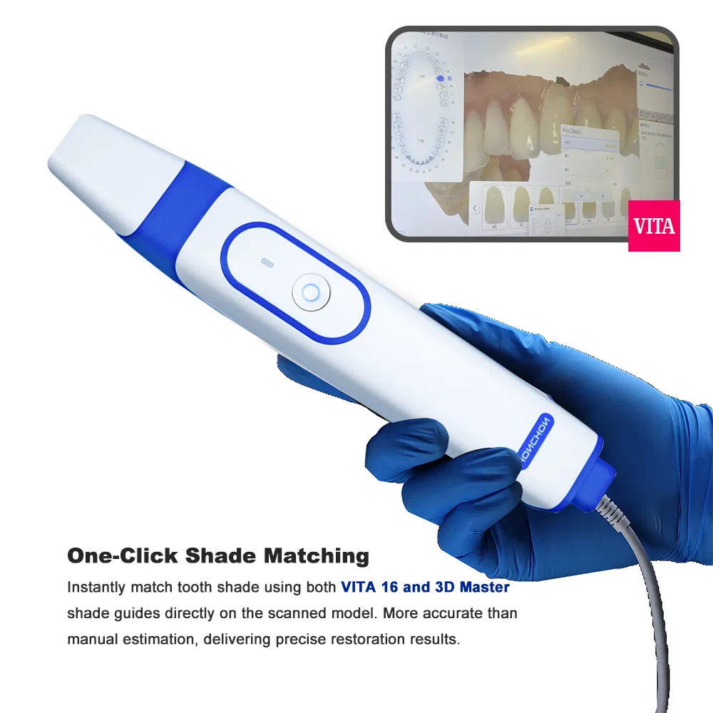 3D Dental Intraoral Scanner for Digital Dentistry Solutions Full Oral Scan
