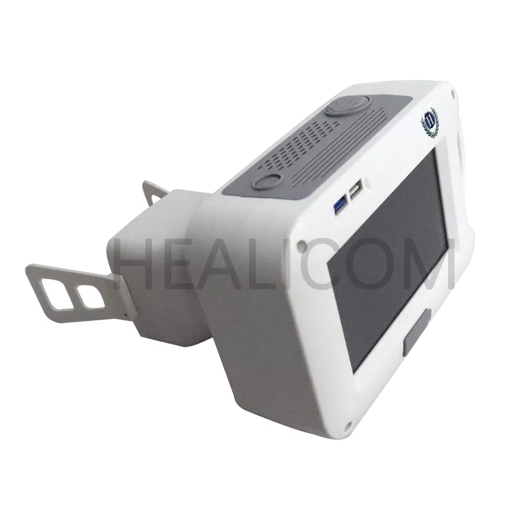 High Quality Dental Medical Portable Hand Held Digital X Ray System