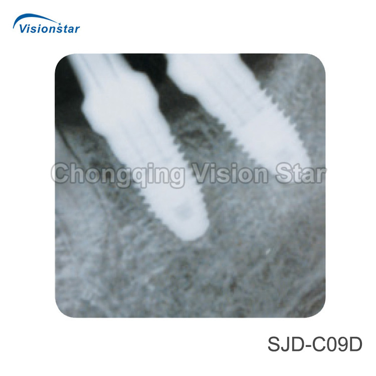 Medical Equipment Cheap Price Clinic Wall-Mounted Dental X Ray Unit