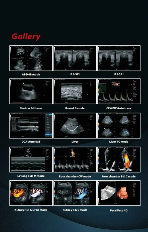 Scanner Diagnostic System