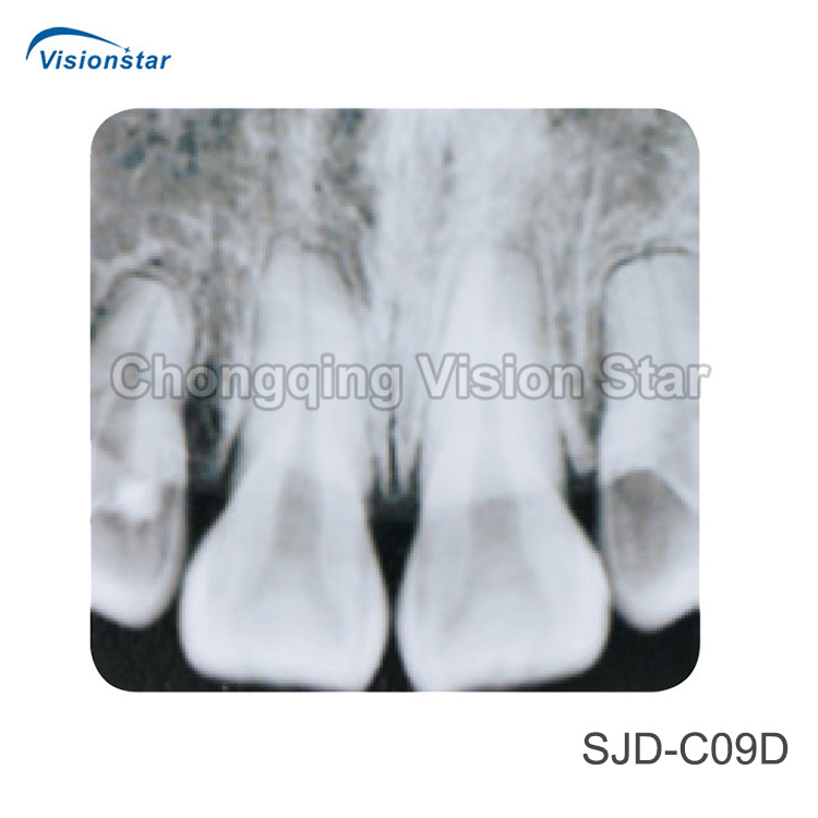 Medical Equipment Cheap Price Clinic Wall-Mounted Dental X Ray Unit