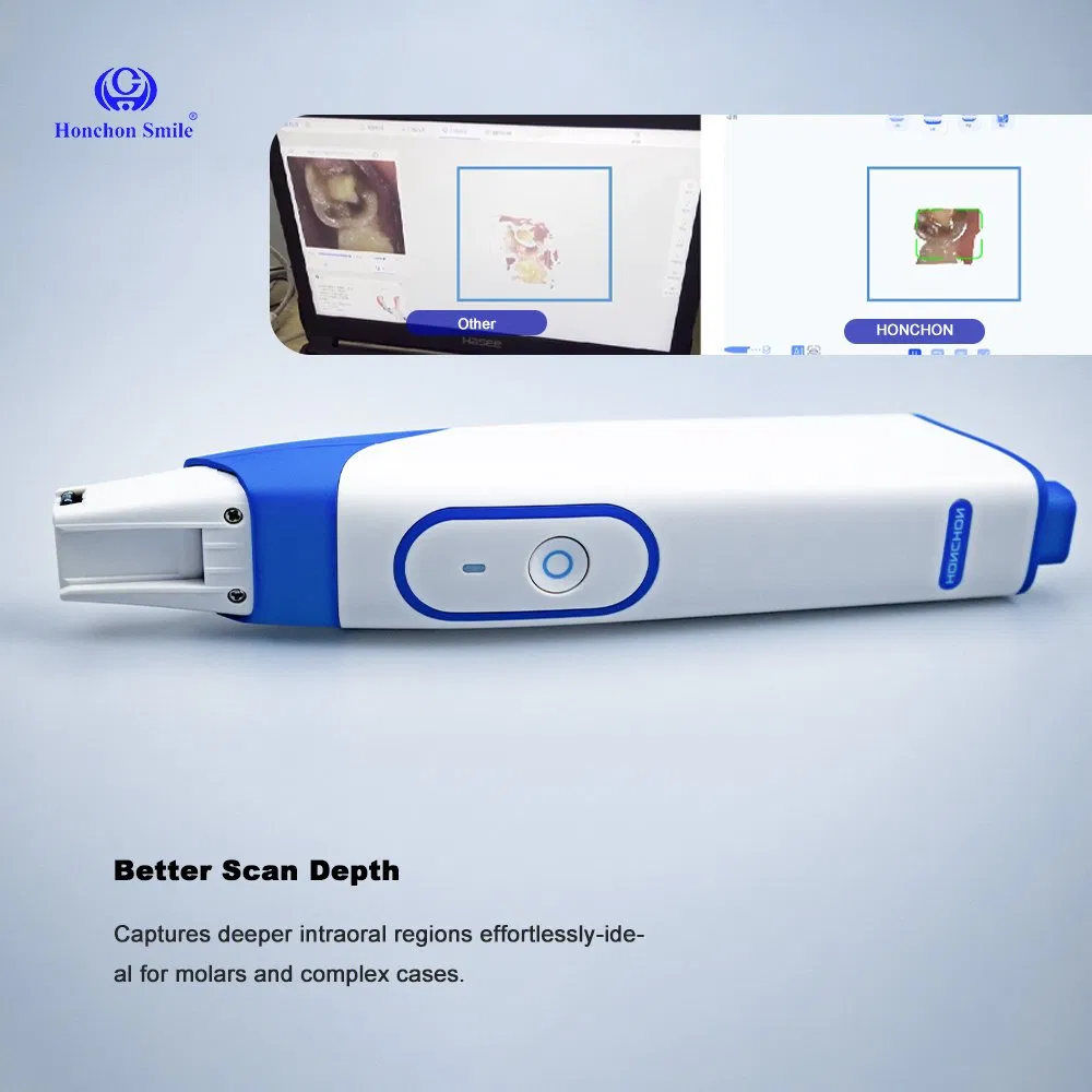 3D Dental Intraoral Scanner for Digital Dentistry Solutions Full Oral Scan