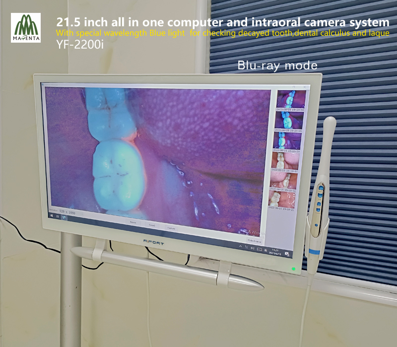High Configuration 21.5" Touch Screen Windows 10 System and Dental Oral Camera Unit with Blue Light for Decayed Tooth/Calculus and Plaque