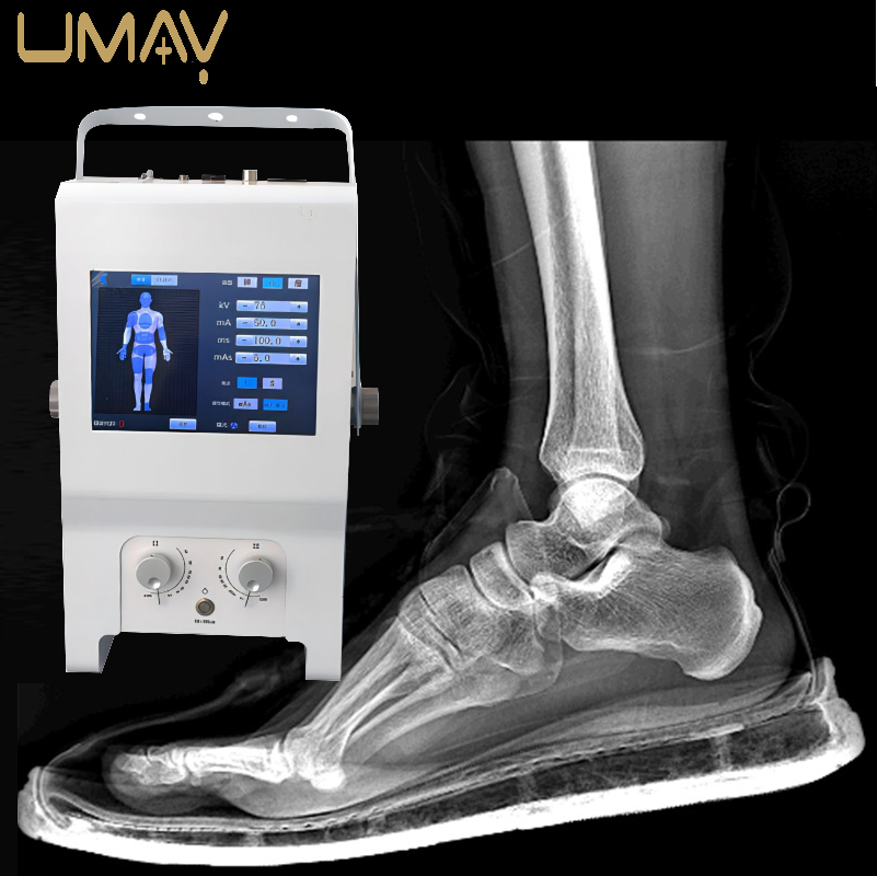 High-Efficiency 5.3kw Dr X-ray System for Medical Use