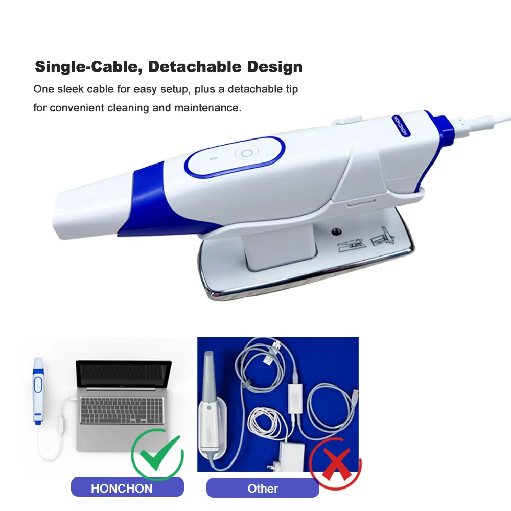 3D Dental Intraoral Scanner for Digital Dentistry Solutions Full Oral Scan
