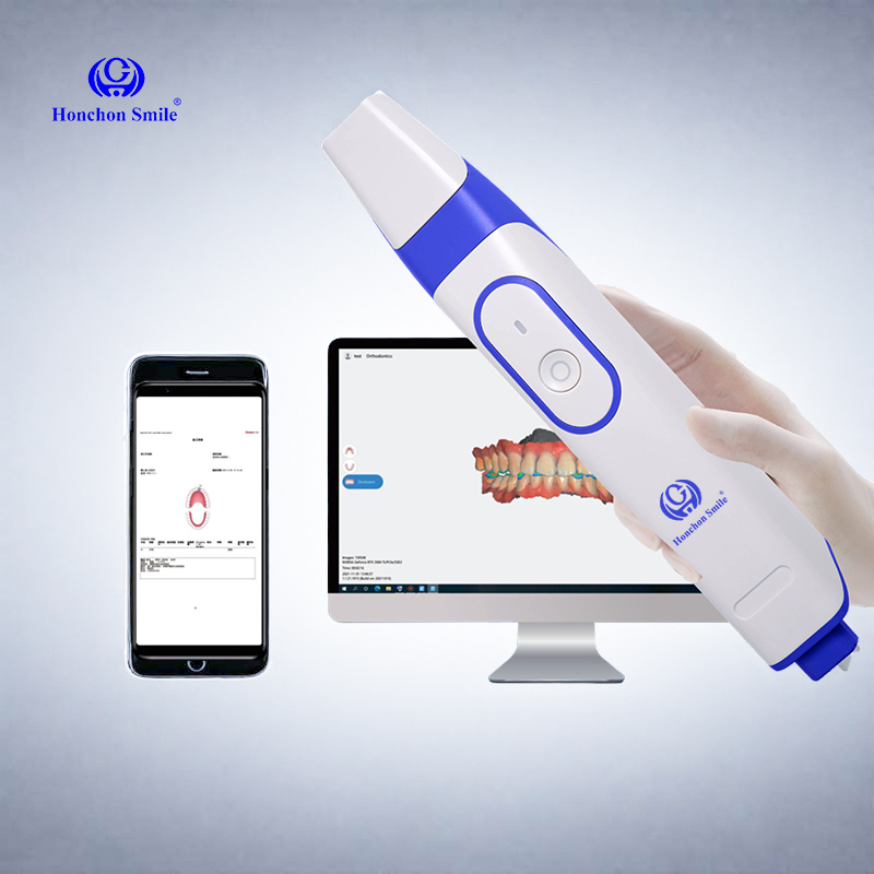 Dental 3D Scanning Device Digital Imaging Cadcam Open System Intraoral Scanner