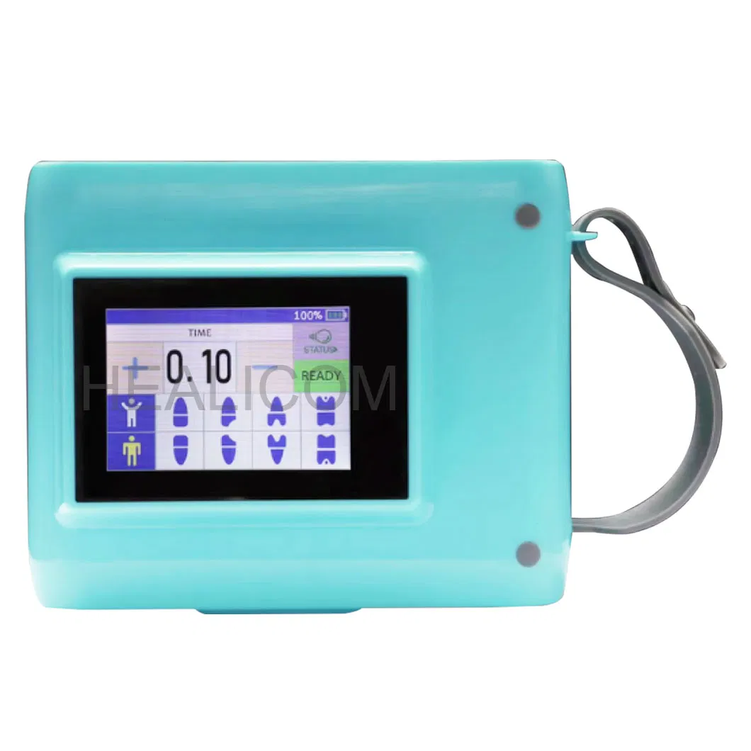 Factory Direct Sales 60kv Portable X-ray Unit Dental X Ray Machine