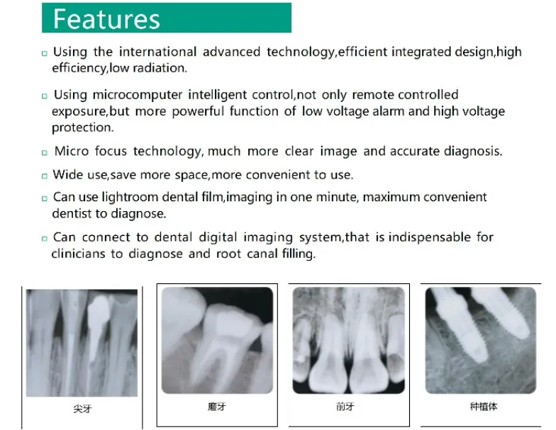 Wall Mounted Dental X Ray Unit - 2