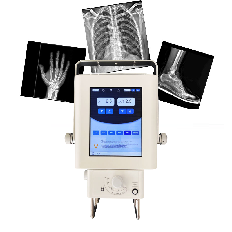 DR X-ray System 1