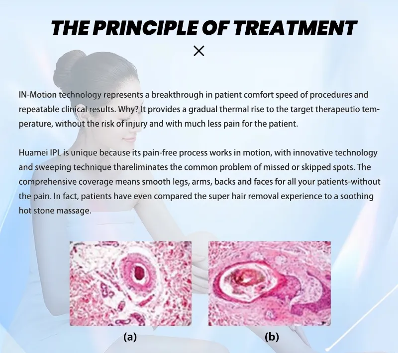 مواصفات مقبض جهاز IPL