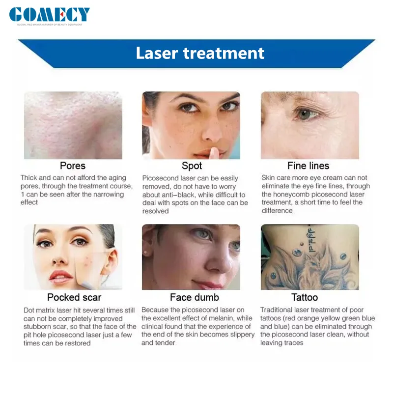 تطبيقات جهاز بيكو ليزر المحمول