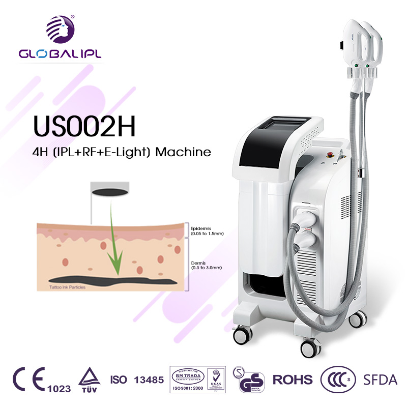 تقنية IPL+RF لإزالة الشعر وتجديد البشرة