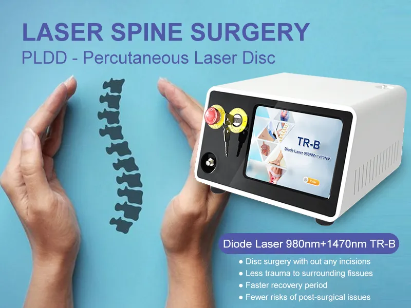 استخدام العيادة 1470nm 980nm جهاز علاج الليزر الثنائي Pldd