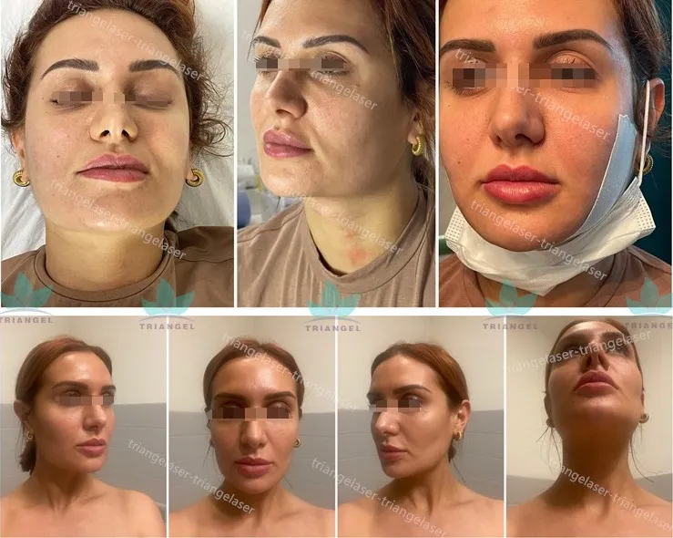 التغذية الراجعة 2
