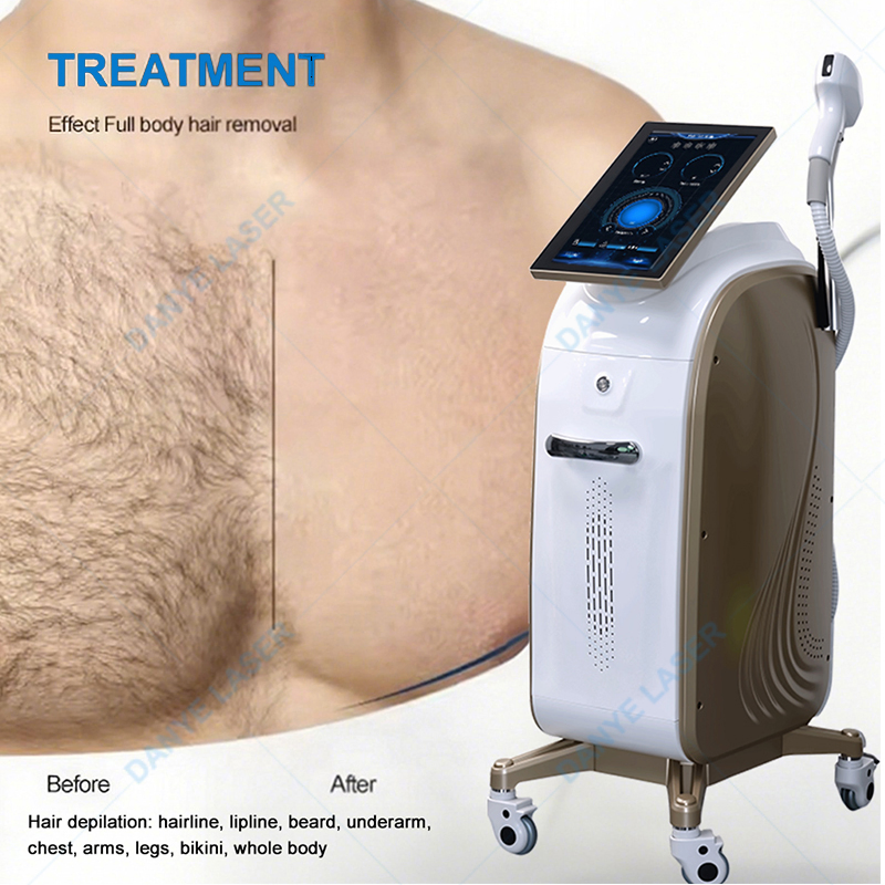 معدات الليزر الثابتة لإزالة الشعر بالليزر الدايود خيارات العلامة التجارية المخصصة