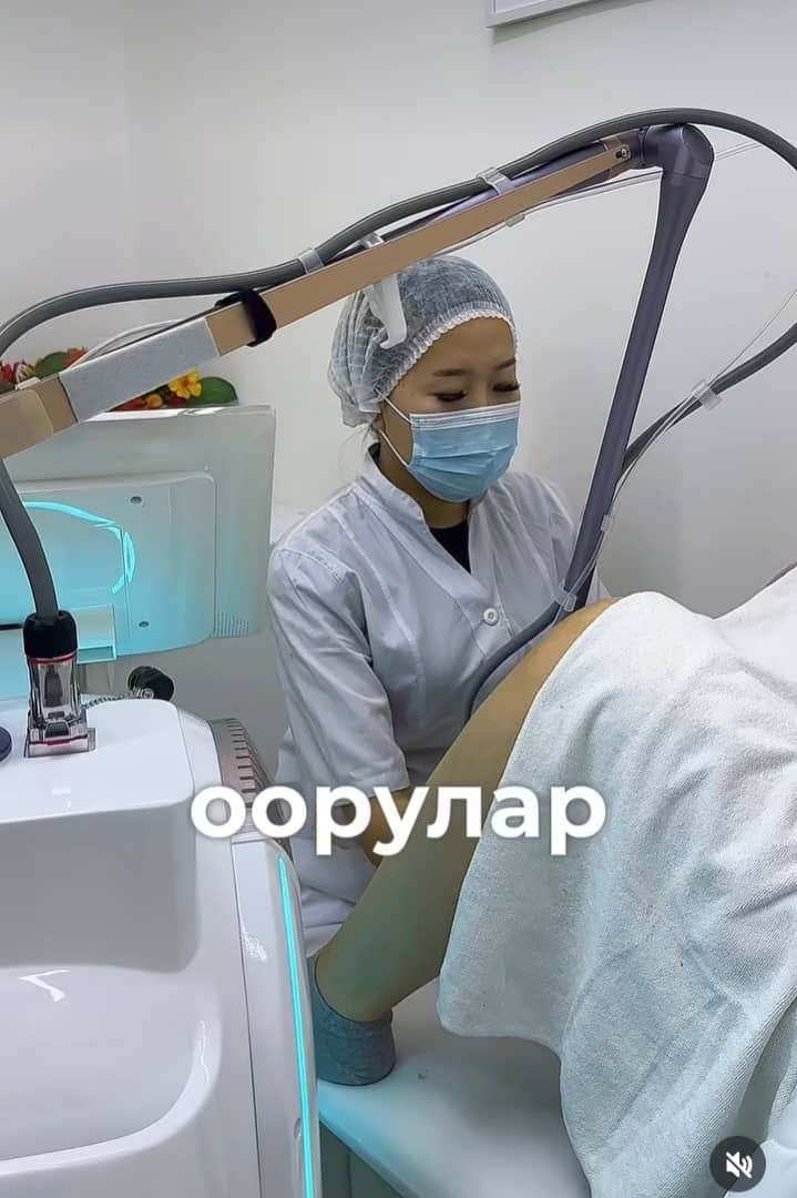 ليزر كيلازر RF CO2 ليزر طبي جزئي 10600nm 7 إصلاح تجديد الجلد المشترك شد إزالة التصبغ