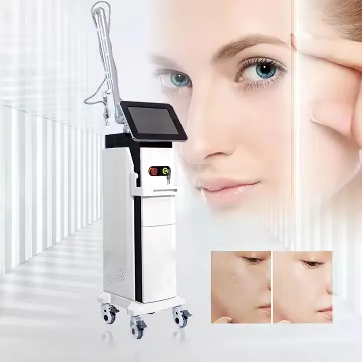 آلة إزالة ندبات المهبل بالليزر
