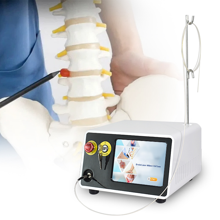 استخدام العيادة 1470nm 980nm جهاز علاج الليزر الثنائي Pldd