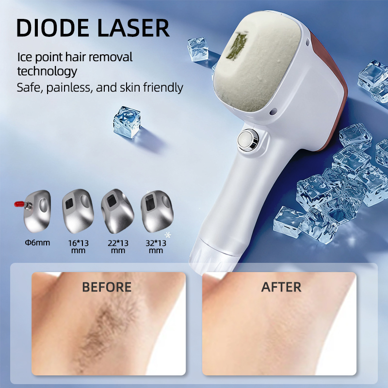 2 In1 إزالة الشعر والتاتو بتقنية IPL و ND YAG Q Switch متعددة الوظائف 2 ضمان لمدة عام ليزر ديود 4 موجات