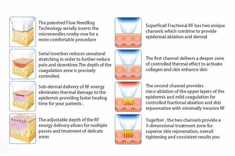 آلة الجمال وإزالة التجاعيد