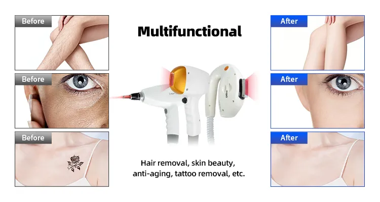 مواصفات جهاز التجميل