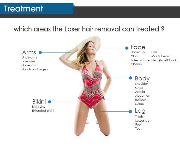 آلة إزالة الشعر بالليزر المتقدم 808nm للصالون