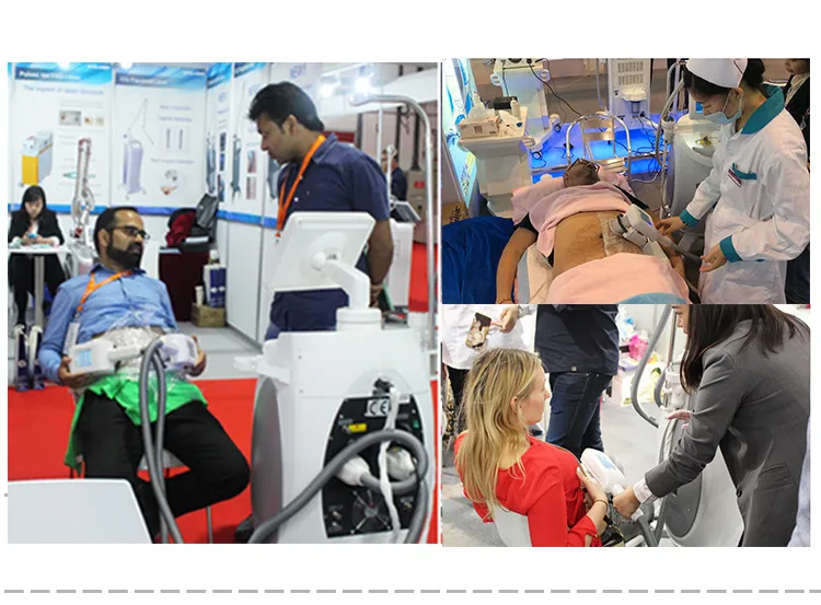 تجديد البشرة طاقة كبيرة جهاز IPL العمودي