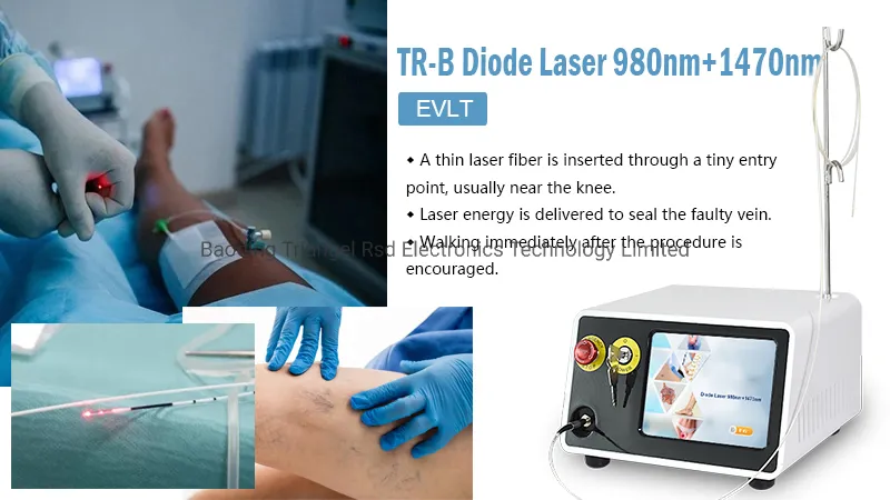 ليزر ثنائي الفينيل فيلبولوجي علاج الدوالي الوريدية بالليزر 980nm 1470nm