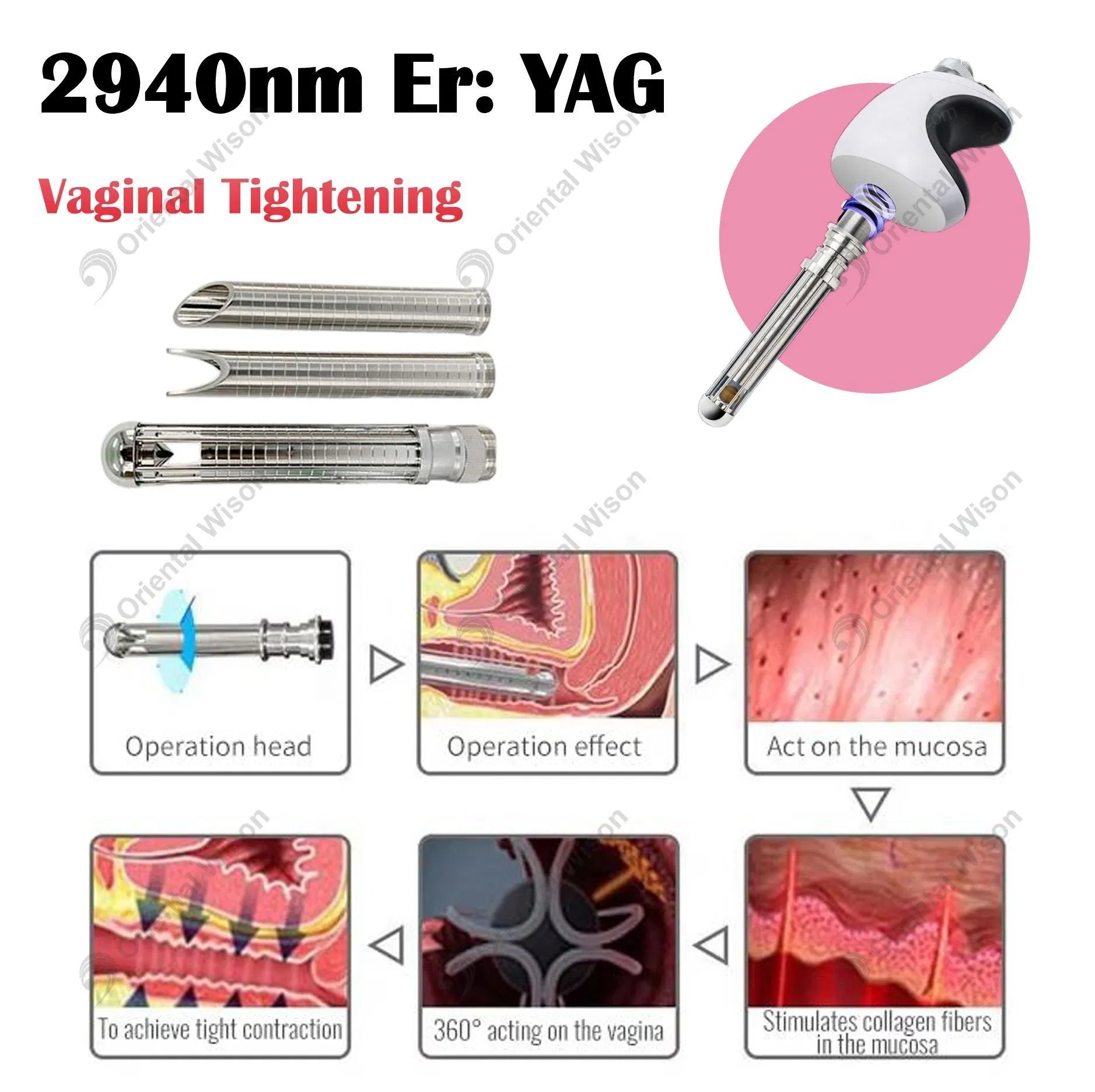 ليزر إربيوم YAG مزدوج الموجة التجاري 2940nm 1064nm تجديد البشرة بالليزر نحت الجسم شد المسام نحت الفرج العناية بالشخير لصالون التجميل العيادة