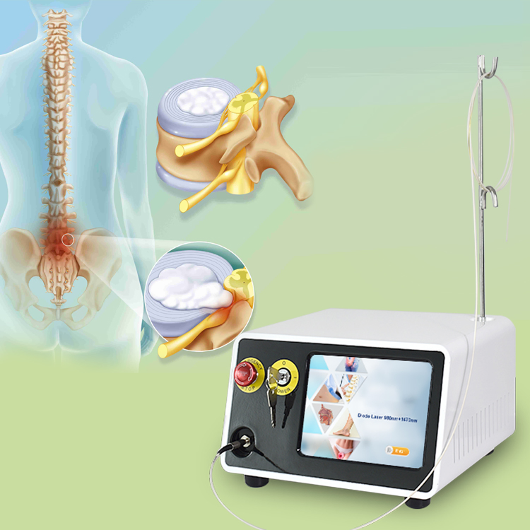 استخدام العيادة 1470nm 980nm جهاز علاج الليزر الثنائي Pldd