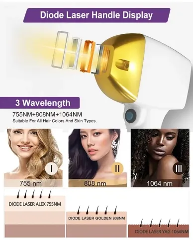 أنظمة إزالة الشعر بالليزر
