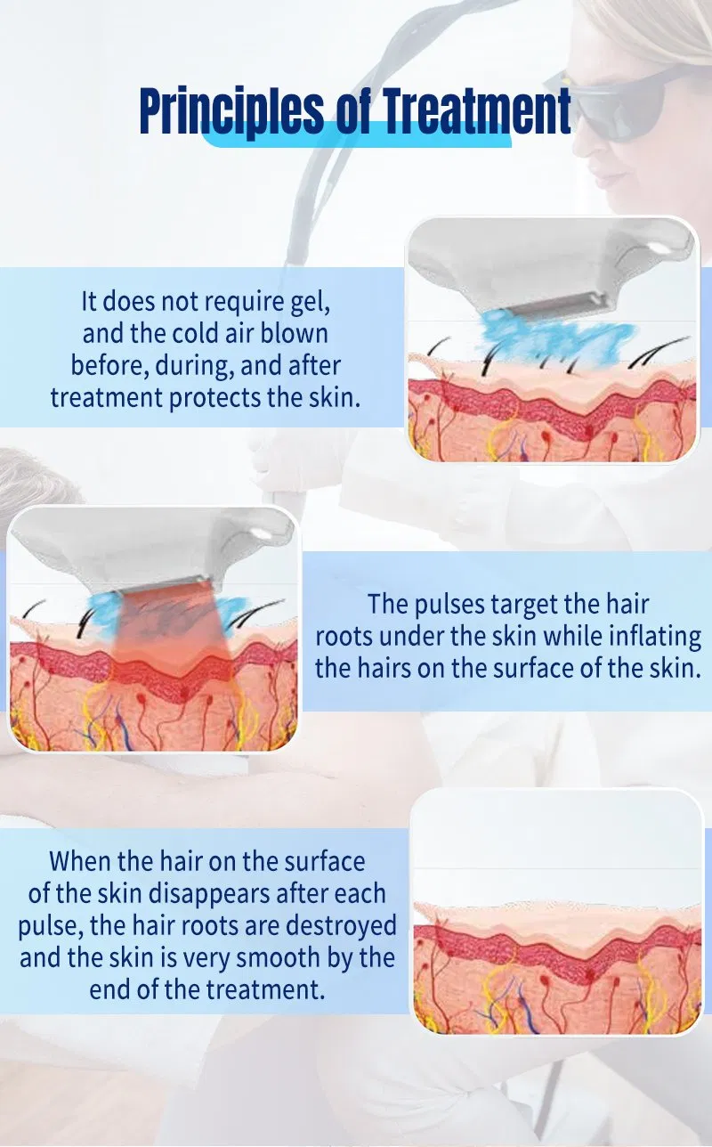 جهاز الليزر المتطور لصالونات التجميل