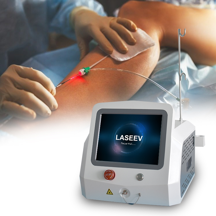 علاج الدوالي بالليزر 980nm نقل ألياف الليزر بالديود لجراحة EVLT minimally invasive