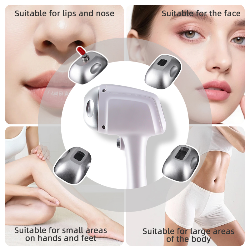 وصول جديد جهاز إزالة الشعر بالليزر المحمول 1200W 1600W 4 موجات 755nm 808nm 940nm 1064nm علاج إزالة الشعر بالليزر الثنائي عالي الكفاءة