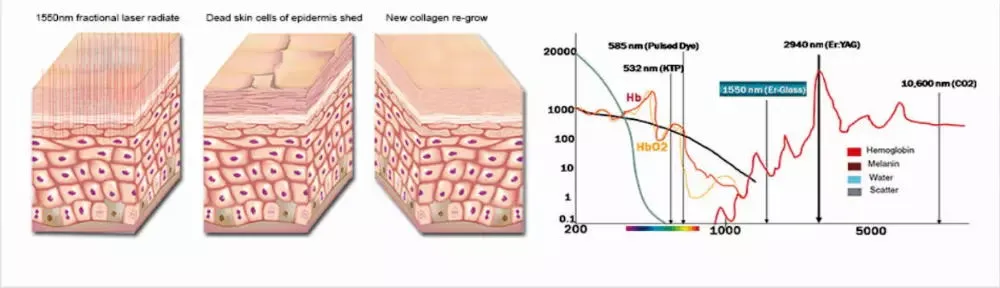 آلة ليزر إير ياج الاحترافية CO2 fractional 1550 لإزالة الندبات وتجديد البشرة باستخدام زجاج ياج 1550 لجمال صالون السبا