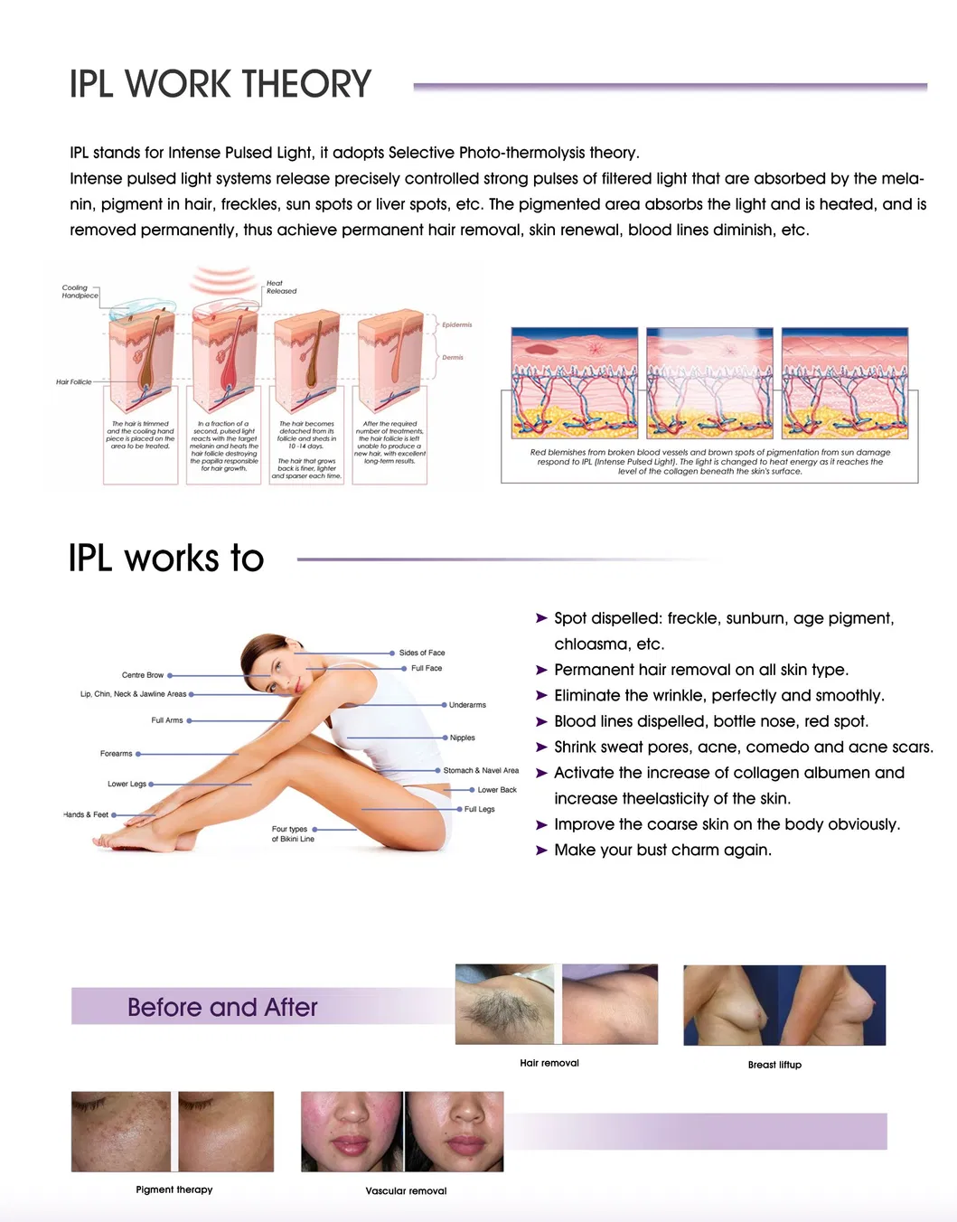 أفضل سعر لجهاز إزالة الشعر بالليزر IPL جهاز إزالة الشعر Elight / معدات تجميل IPL