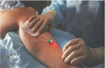 خطوات العلاج 1