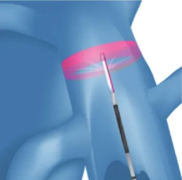 خطوات العلاج 3