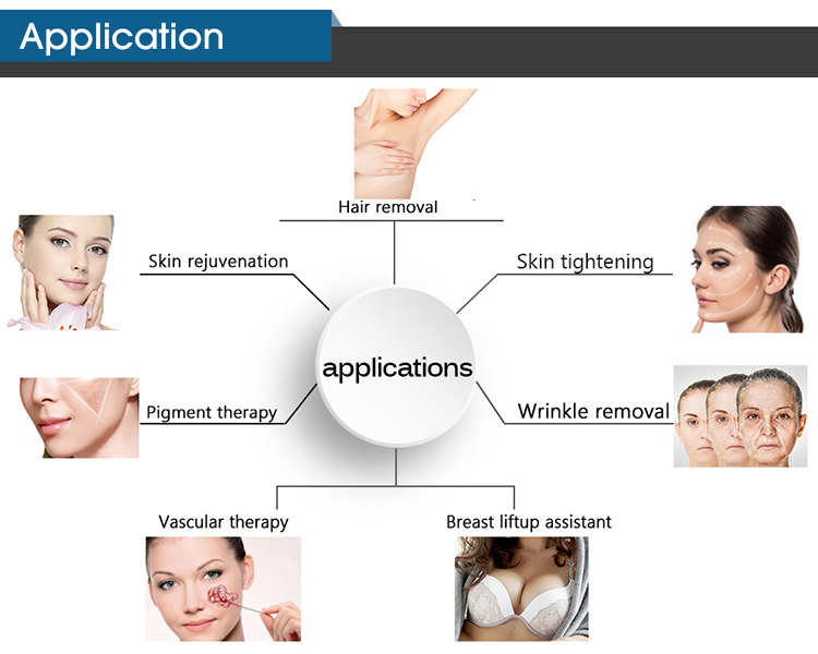 2023 جهاز إزالة الشعر بالليزر IPL لإزالة الشعر بشكل دائم وتجديد البشرة