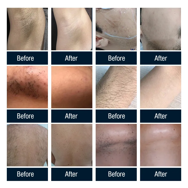 مواصفات Areslite