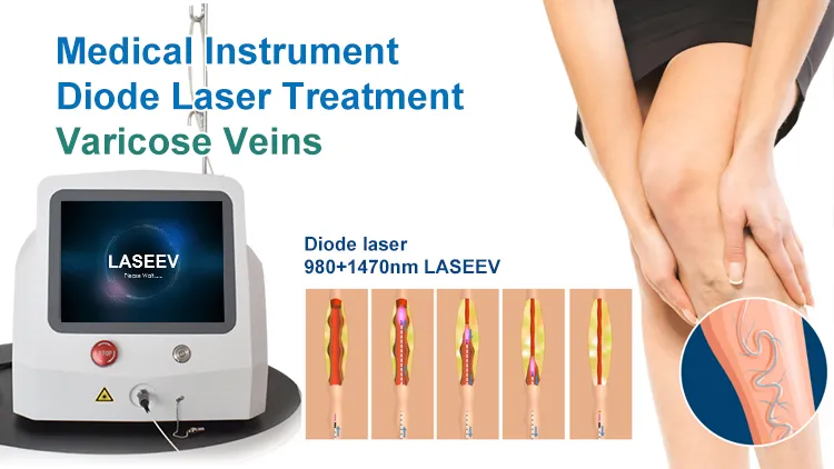 علاج الدوالي بالليزر 980nm نقل ألياف الليزر بالديود لجراحة EVLT minimally invasive