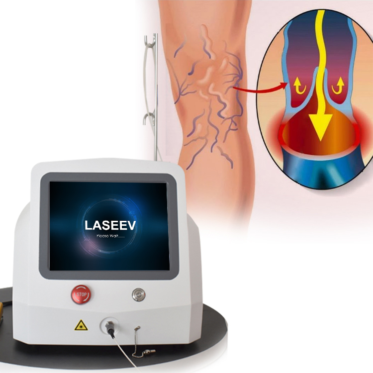 علاج الدوالي بالليزر 980nm نقل ألياف الليزر بالديود لجراحة EVLT minimally invasive
